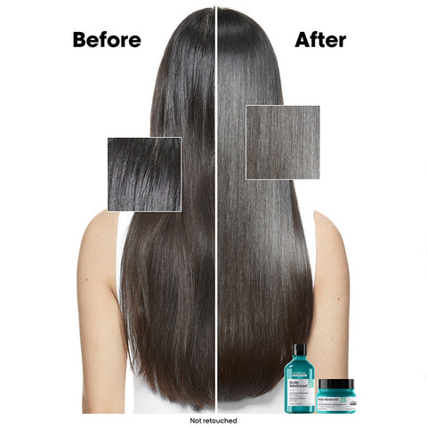 L'Oreal Scalp Advanced Anti-Oiliness Professional Shampoo 300ml